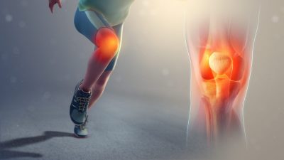 what is runners knee